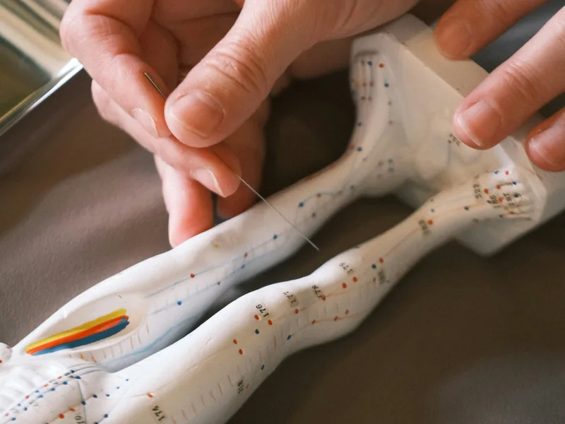 Acupuncture at Next Level Chiropractic & Wellness in Caro