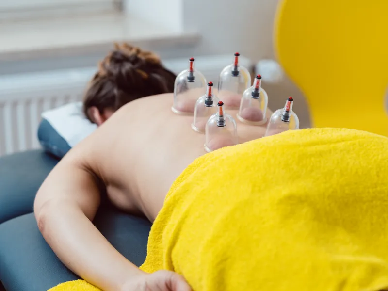 Cupping Therapy at Next Level Chiropractic & Wellness in Caro