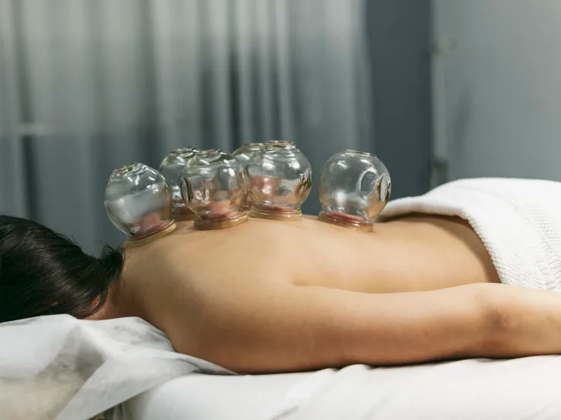 Cupping Therapy at Next Level Chiropractic & Wellness in Caro