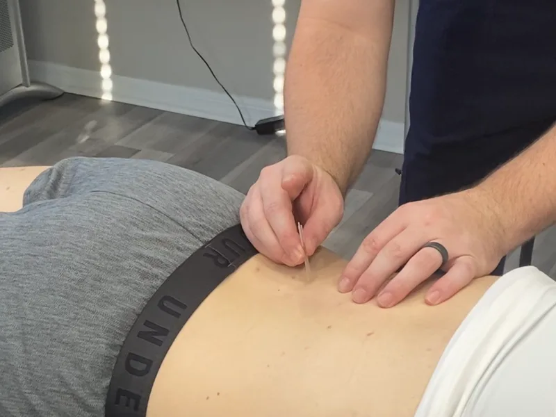 How Dry Needling works at Next Level Chiropractic & Wellness
