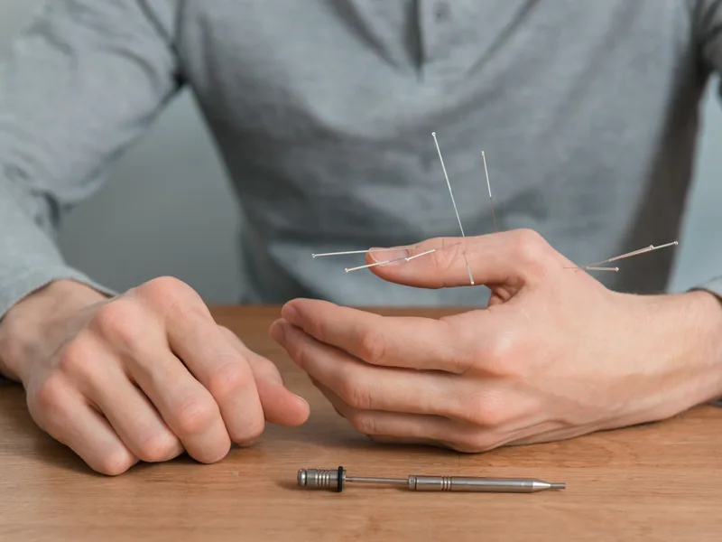 Dry Needling at Next Level Chiropractic & Wellness in Caro